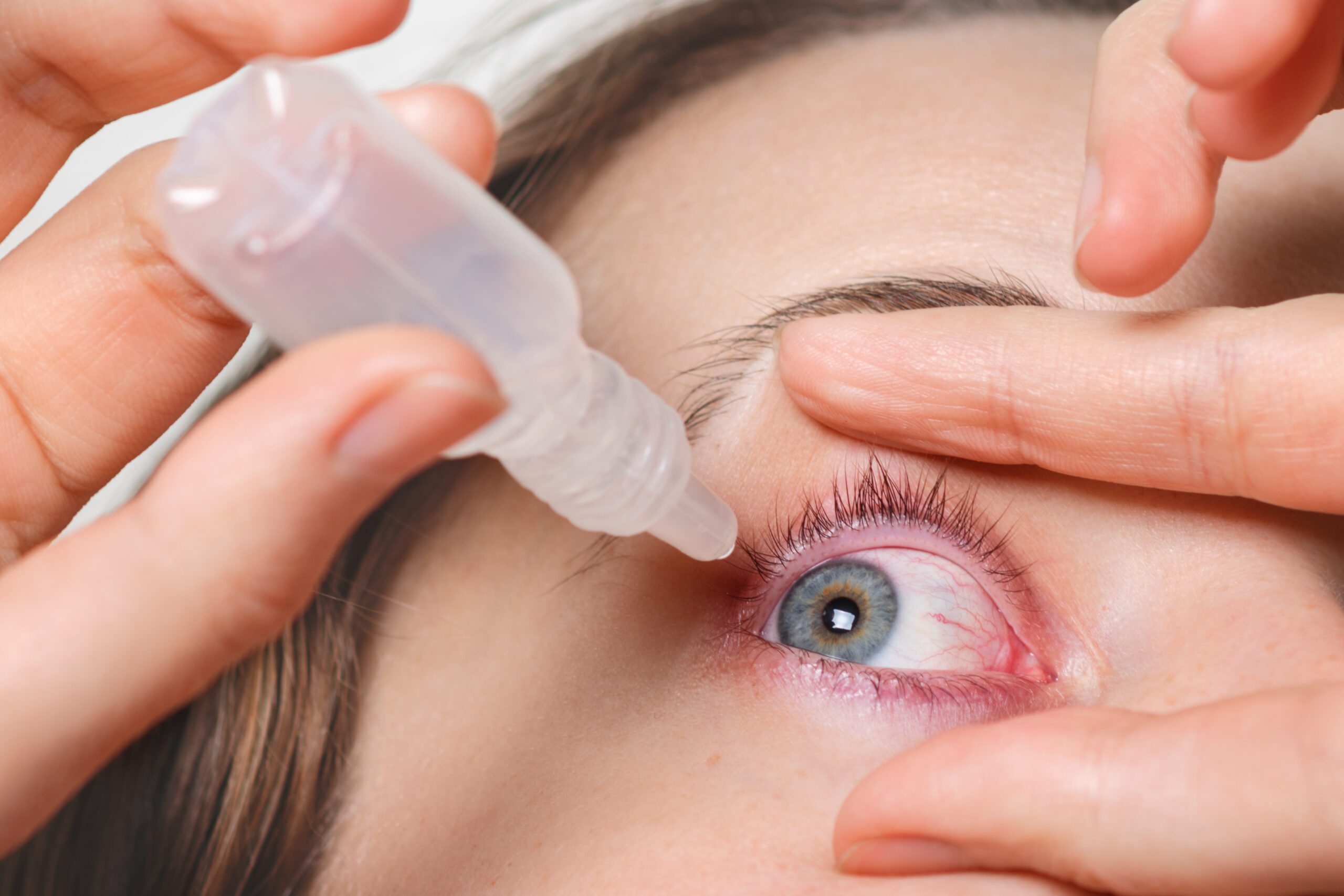 Understanding conjunctivitis article