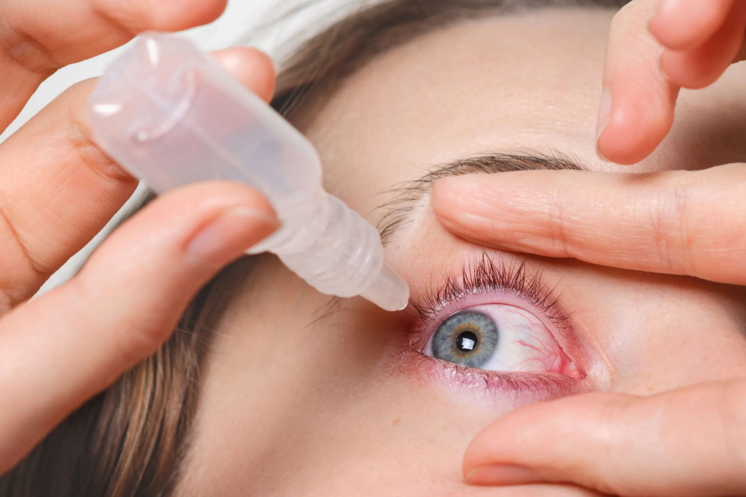 Understanding conjunctivitis article